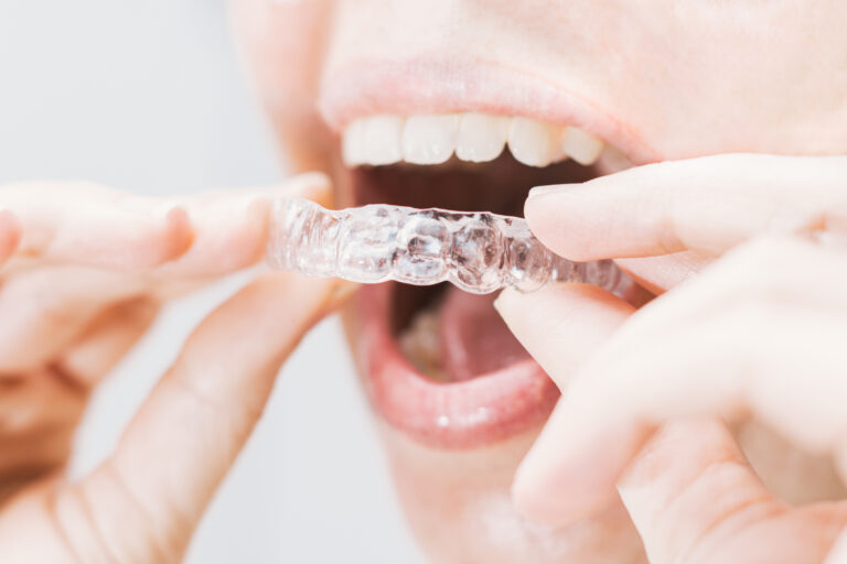 Invisalign precio y tratamiento en Astrabudua